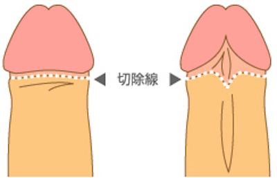 上野クリニック：複合曲線作図法