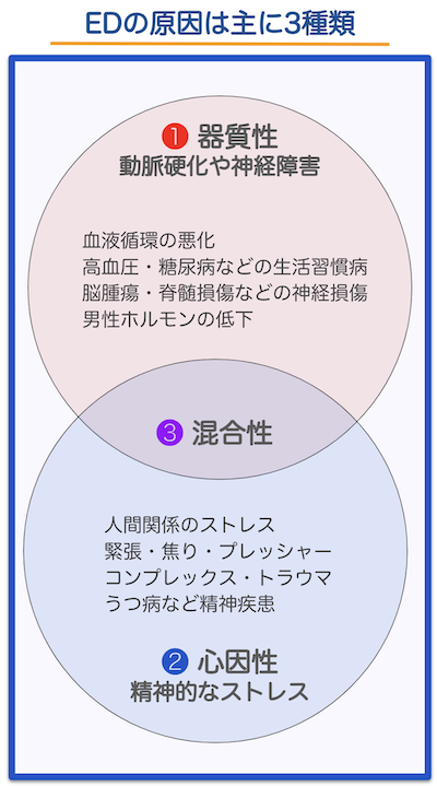 EDの原因3つ