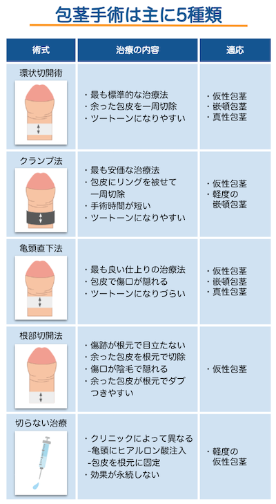 包茎の手術は主に5種類