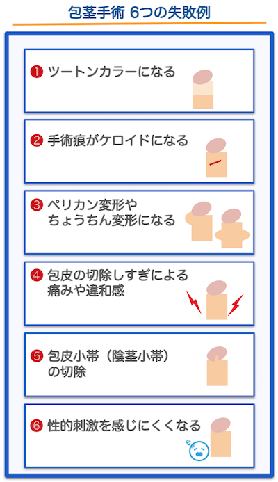 包茎手術失敗例